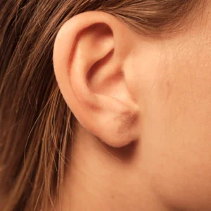 Réflexologie auriculaire sur l’oreille dans une séance de réflexologie combinée